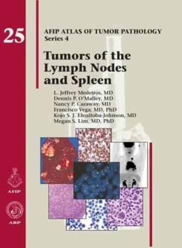 Tumors of the Lymph Node and Spleen: No. 25 (AFIP Atlas of Tumor Pathology, Series 4,)