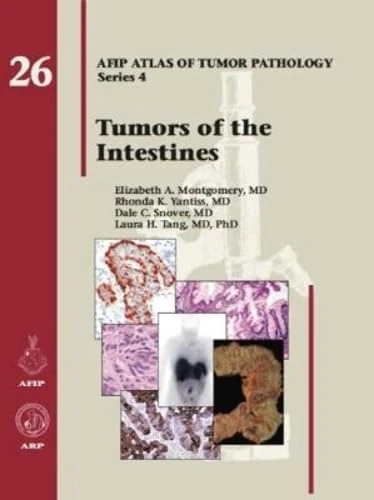Tumors of the Intestines: No. 26 (AFIP Atlas of Tumor Pathology, Series 4,)