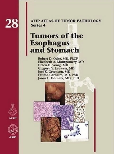 Tumors of the Esophagus and Stomach (AFIP Atlas of Tumor Pathology, Series 4,): No. 28
