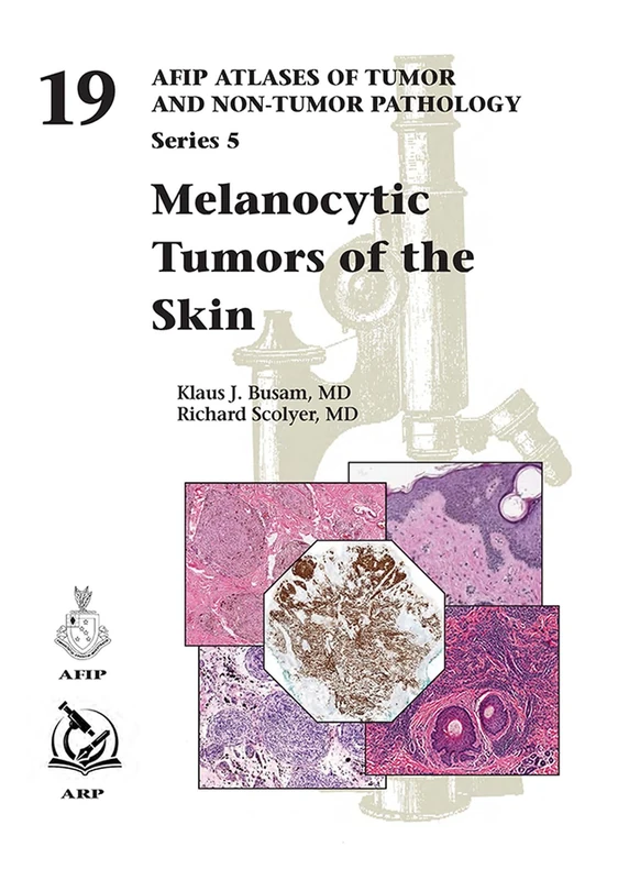 Melanocytic Tumors of Skin: 19 (AFIP Atlas of Tumor and Non-Tumor Pathology, Series 5)