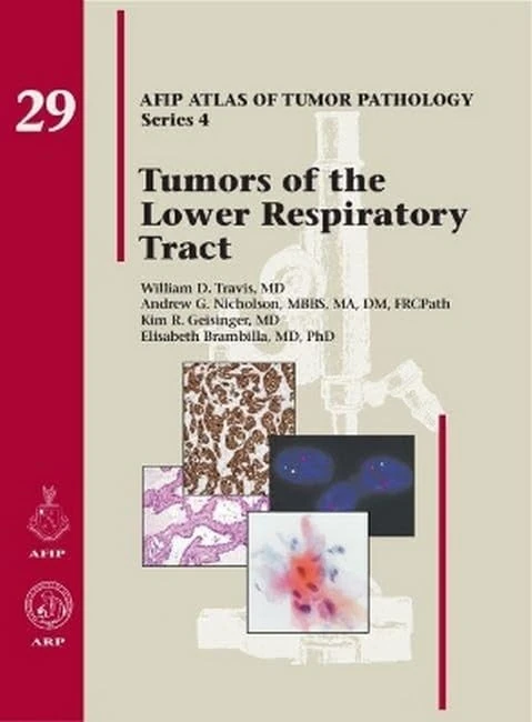 Tumors of the Lower Respiratory Tract: No. 29 (AFIP Atlas of Tumor Pathology, Series 4)