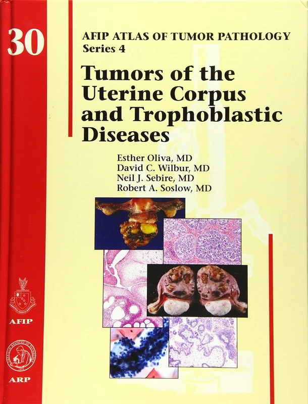 Tumors of the Uterine Corpus and Gestational Trophoblastic Diseases: No.30 (AFIP Atlas of Tumor Pathology, Series 4)