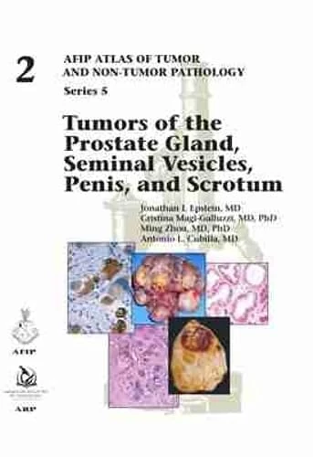 Tumors of the Prostate Gland, Seminal Vesicles, Penis, and Scrotum: 2 (AFIP Atlas of Tumor and Non-Tumor Pathology, Series 5)