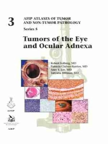 Tumors of the Eye and Ocular Adnexa: 3 (AFIP Atlas of Tumor and Non-Tumor Pathology, Series 5)