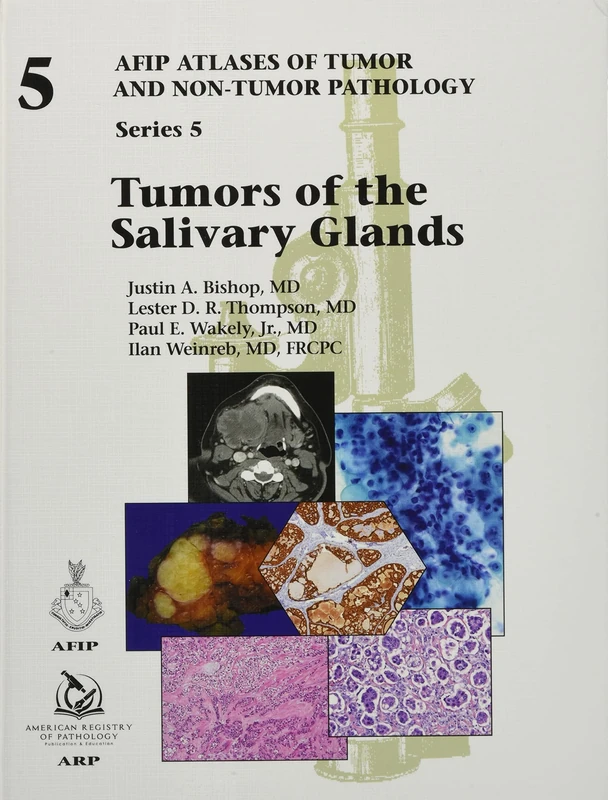 Tumors of the Salivary Glands (AFIP Atlases of Tumor and Non-Tumor Pathology, Series 5) (AFIP Atlas of Tumor and Non-Tumor Pathology, Series 5)