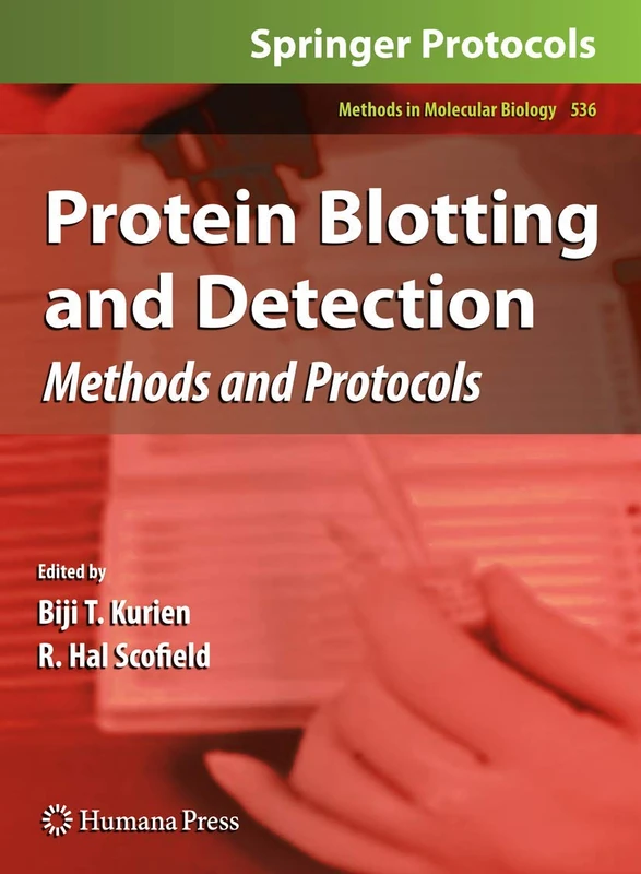 Protein Blotting and Detection: Methods and Protocols: 536 (Methods in Molecular Biology, 536)