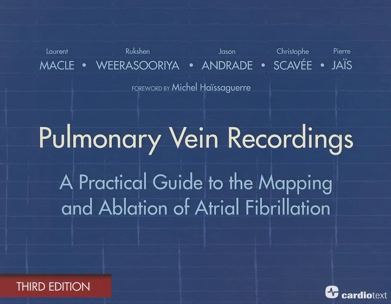 Pulmonary Vein Recordings: A Practical Guide to the Mapping and Ablation of Atrial Fibrillation