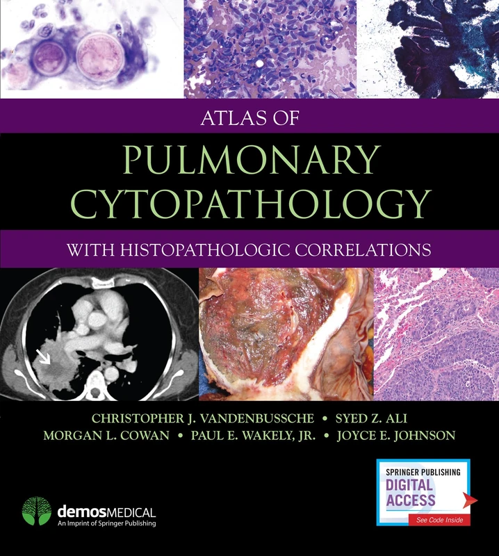 Atlas of Pulmonary Cytopathology: With Histopathologic Correlations