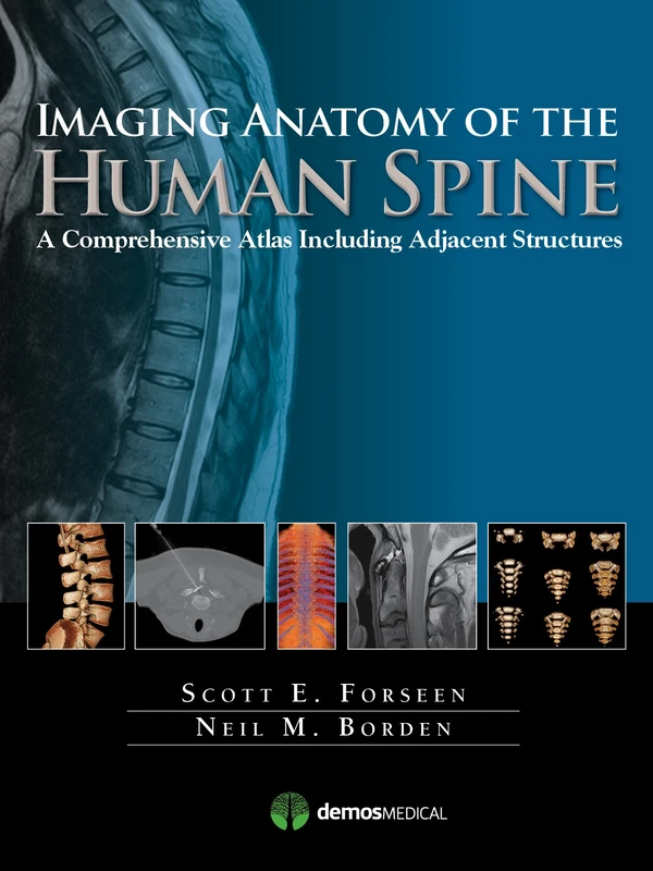 Multimodality Atlas of the Human Spine: A Comprehensive Atlas Including Adjacent Structures