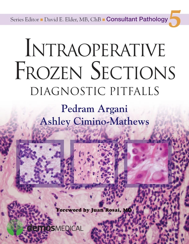 Demos Medical Intraoperative Frozen Sections Diagnostic Pitfalls