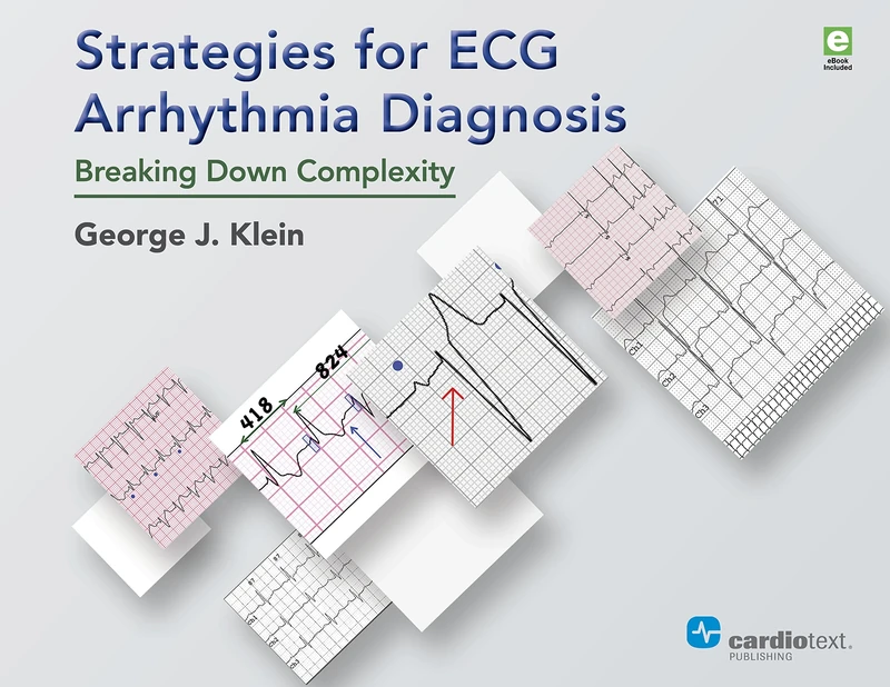 Strategies for ECG Arrhythmia Diagnosis: Breaking Down Complexity