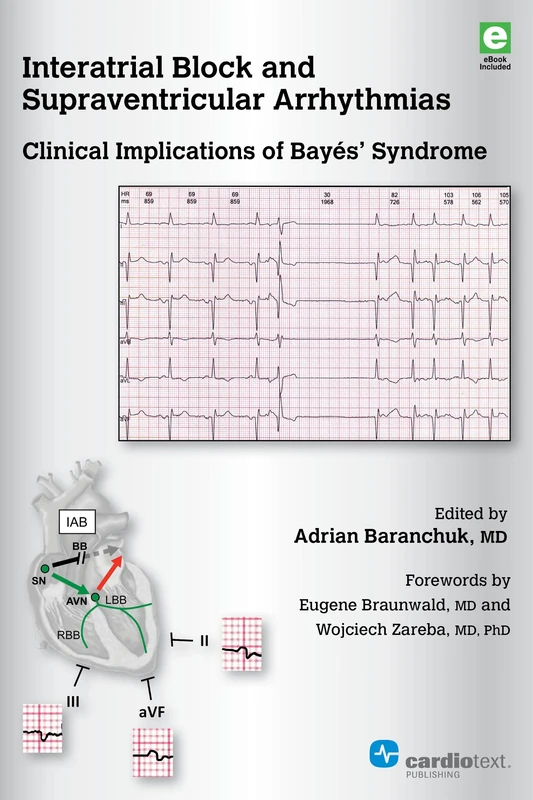 Interatrial Block and Supraventricular Arrhythmias: Clinical Implications of Bayes' Syndrome - Image 1