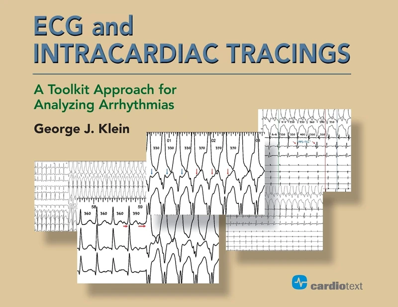 ECG and Intracardiac Tracings: A Toolkit Approach for Analyzing Arrhythmias