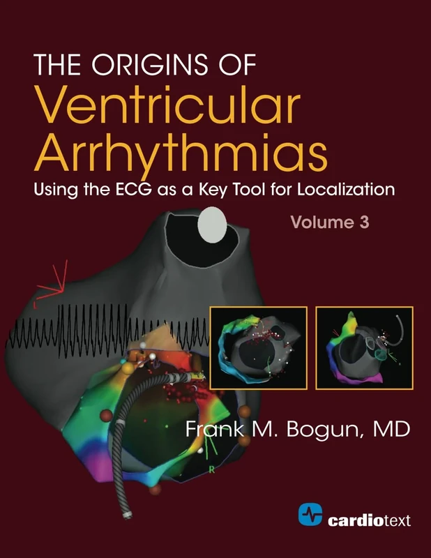 The Origins of Ventricular Arrhythmias, Volume 3: Using the ECG as a Key Tool for Localization, Volume 3