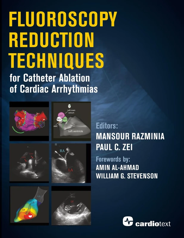 Fluoroscopy Reduction Techniques for Catheter Ablation of Cardiac Arrhythmias