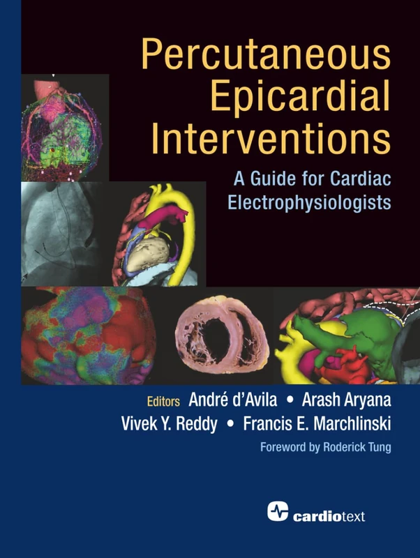 Percutaneous Epicardial Interventions:: A Guide for Cardiac Electrophysiologists