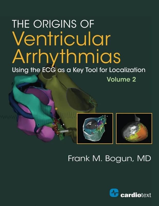 The Origins of Ventricular Arrhythmias, Volume 2: Using the ECG as a Key Tool for Localization: Using the ECG as a Key Tool for Localization, Volume 2