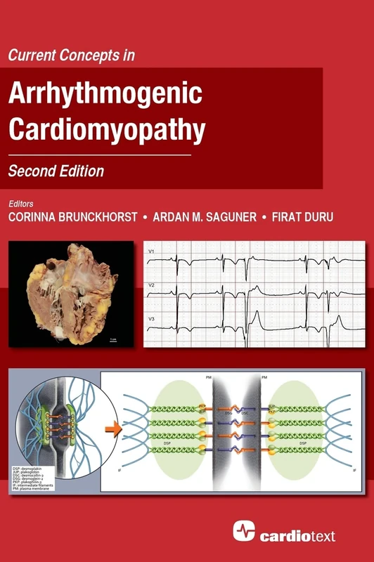 Current Concepts in Arrhythmogenic Cardiomyopathy, Second Edition: