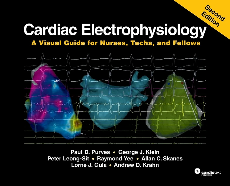 Cardiac Electrophysiology , Second Edition: A Visual Guide for Nurses, Techs, and Fellows