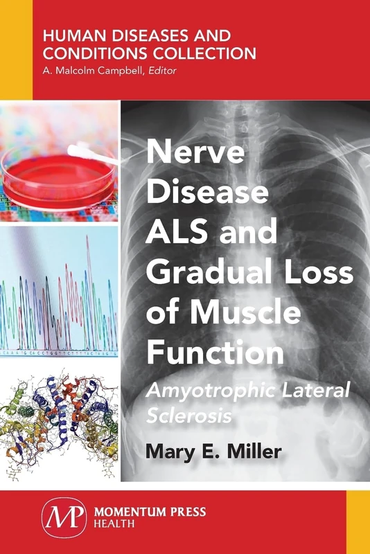 Nerve Disease ALS and Gradual Loss of Muscle Function: Amyotrophic Lateral Sclerosis (Human Diseases and Conditions Collection)
