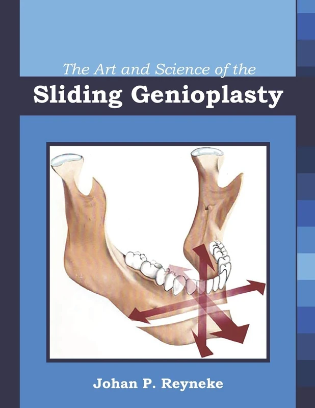 The Art and Science of the Sliding Genioplasty - Image 1