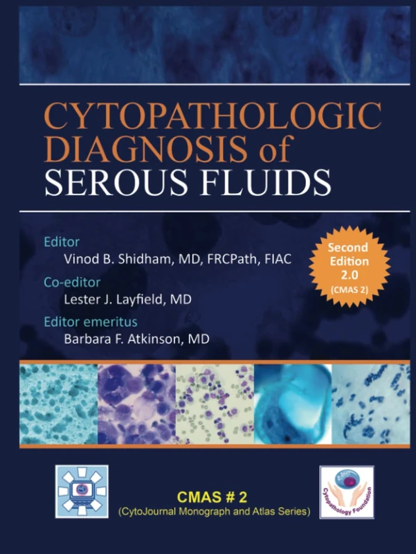 CYTOPATHOLOGIC DIAGNOSIS of SEROUS FLUIDS (CMAS (CytoJournal Monograph / Atlas Series)) - Image 1