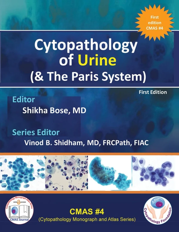 Cytopathology of Urine (& The Paris System) (CMAS #4): Urine Cytology - Image 1