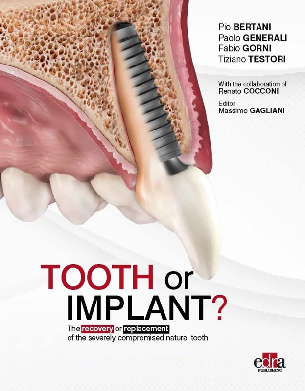 Edra Tooth or Implant - Dentistry Science and Medicine Book