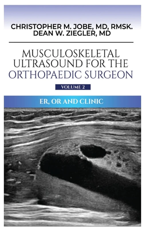Musculoskeletal Ultrasound for the Orthopaedic Surgeon OR, ER and Clinic, Volume 2 - Image 1
