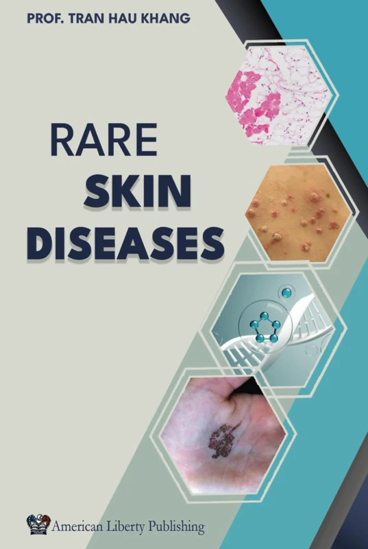 Rare Skin Diseases