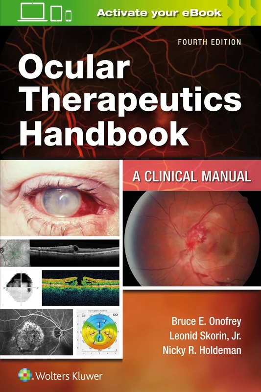 Ocular Therapeutics Handbook: A Clinical Manual
