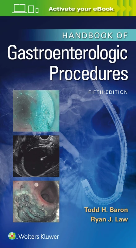 Handbook of Gastroenterologic Procedures (Lippincott Williams and Wilkins Handbook Series)