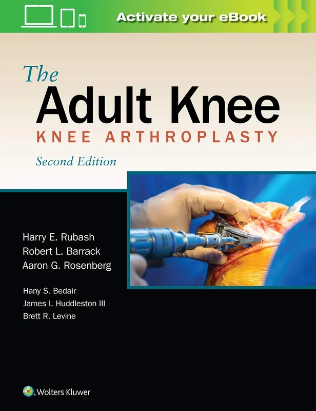 The Adult Knee: Knee Arthroplasty