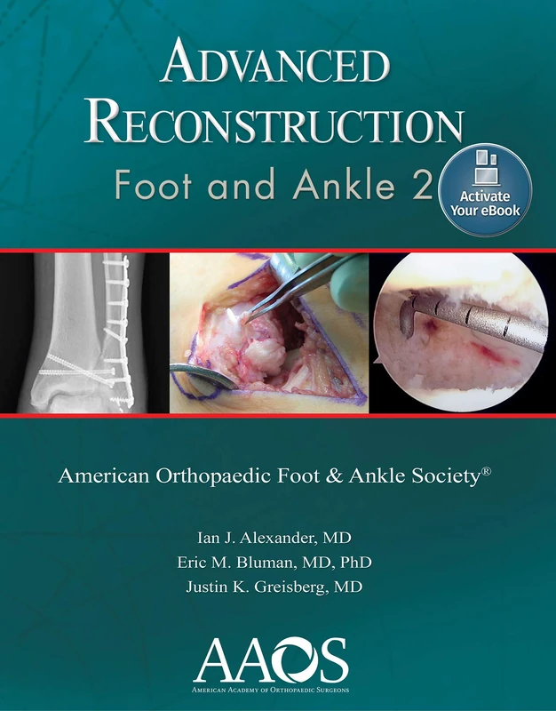Advanced Reconstruction: Foot and Ankle 2: Print + Ebook: Foot and Ankle 2: Ebook without Multimedia (AAOS - American Academy of Orthopaedic Surgeons)