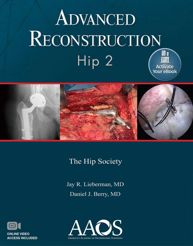 Advanced Reconstruction: Hip 2: Print + Ebook with Multimedia: Hip 2: Ebook without Multimedia (AAOS - American Academy of Orthopaedic Surgeons)