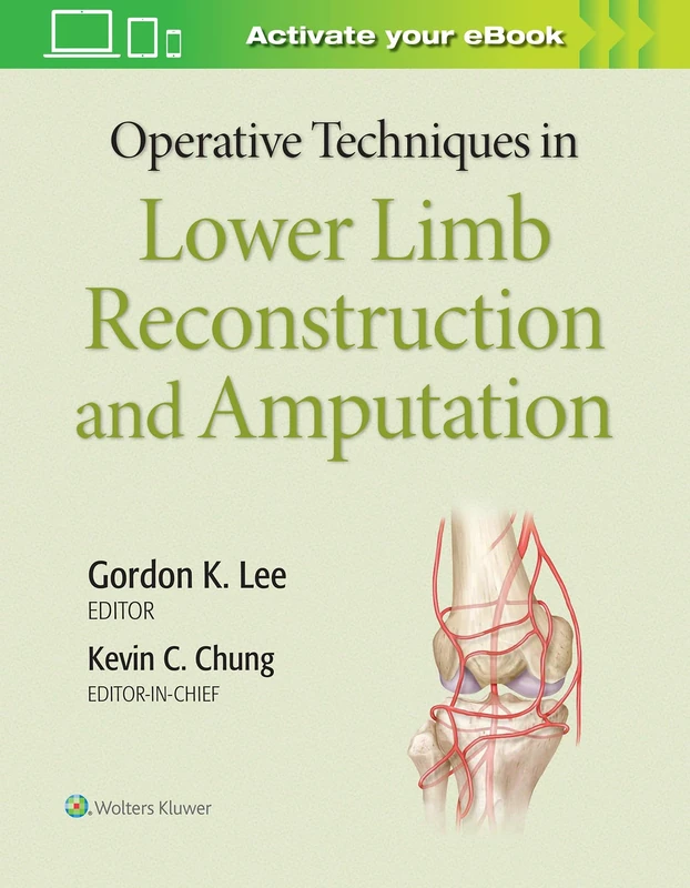 Operative Techniques in Lower Limb Reconstruction and Amputation: Lower Limb Surgery