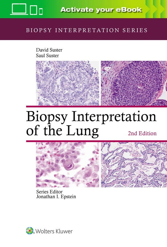 Biopsy Interpretation of the Lung (Biopsy Interpretation Series)