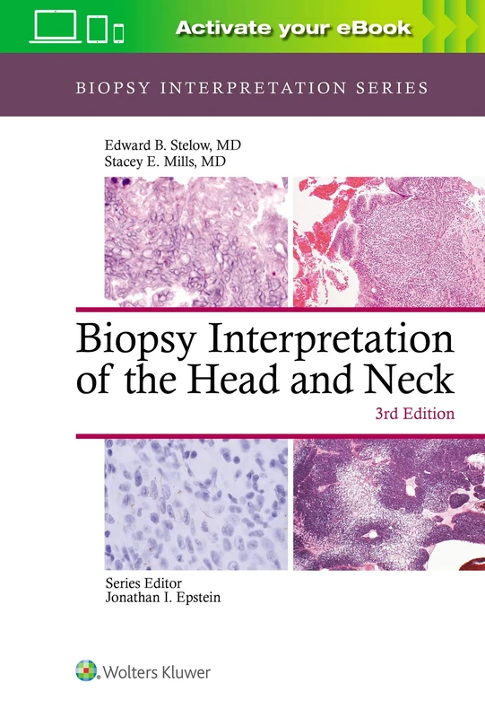 Biopsy Interpretation of the Head and Neck (Biopsy Interpretation Series)