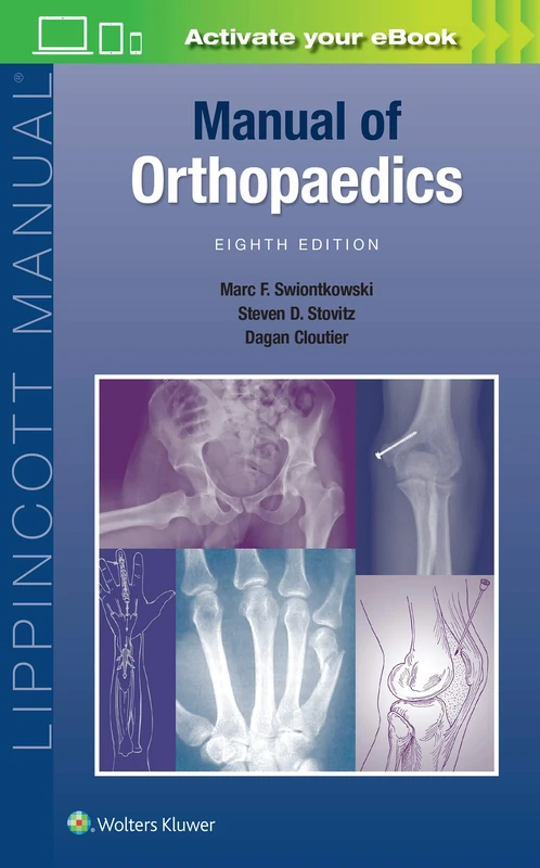 Manual of Orthopaedics (Lippincott Manual Series)