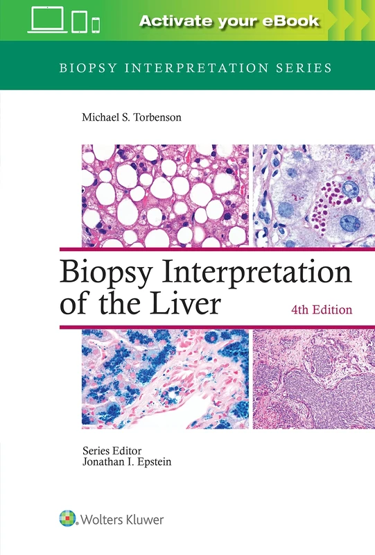Biopsy Interpretation of the Liver (Biopsy Interpretation Series)