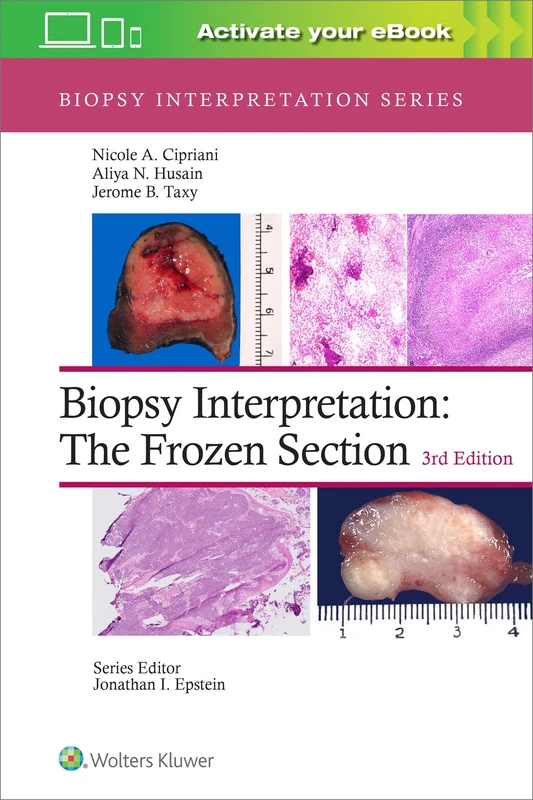 Biopsy Interpretation: The Frozen Section: Print + eBook with Multimedia: The Frozen Section: eBook with Multimedia (Biopsy Interpretation Series)