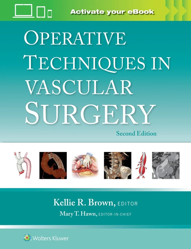 Operative Techniques in Vascular Surgery: eBook with Multimedia