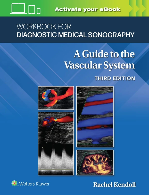 Workbook for Diagnostic Medical Sonography: The Vascular Systems (Lippincott Connect)