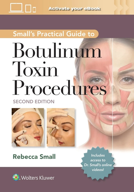 Small's Practical Guide to Botulinum Toxin Procedures: eBook with Multimedia