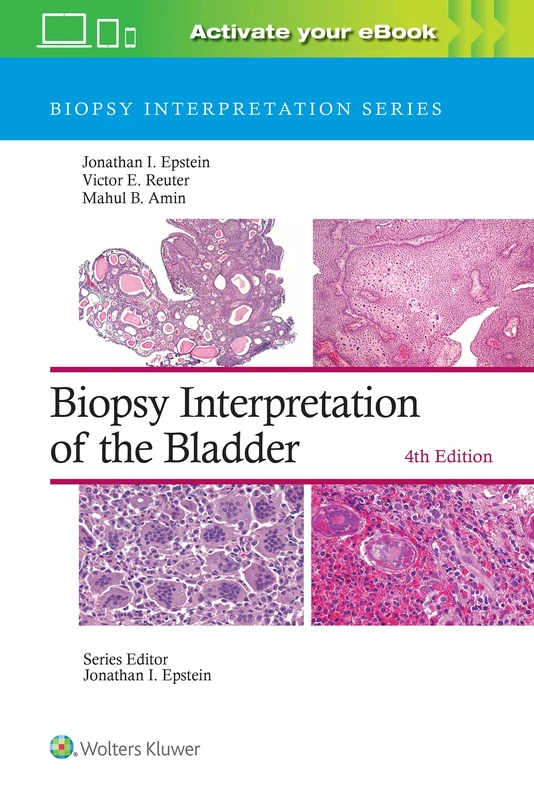Biopsy Interpretation of the Bladder: Print + eBook with Multimedia (Biopsy Interpretation Series)