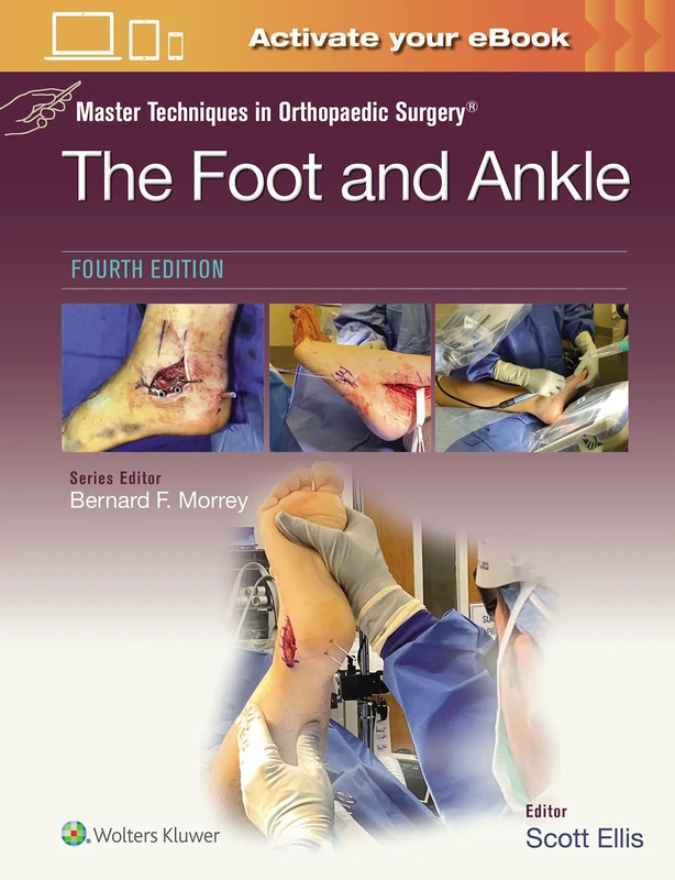 Master Techniques in Orthopaedic Surgery: The Foot and Ankle: Print + eBook with Multimedia: The Foot and Ankle: eBook with Multimedia