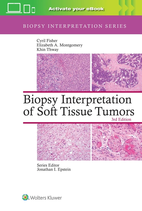 Biopsy Interpretation of Soft Tissue Tumors: Print + eBook with Multimedia (Biopsy Interpretation Series)