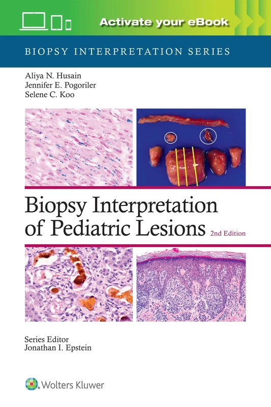 Biopsy Interpretation of Pediatric Lesions: Print + eBook with Multimedia: Biopsy Interpretation Series