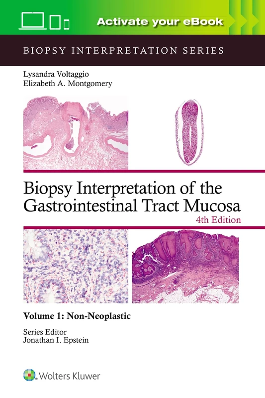 Biopsy Interpretation of the Gastrointestinal Tract Mucosa Volume 1: Non-Neoplastic: Print + eBook with Multimedia (Biopsy Interpretation Series)