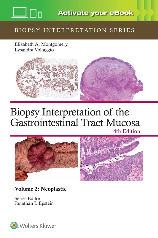 Biopsy Interpretation of the Gastrointestinal Tract Mucosa Volume 2: Neoplastic: Print + eBook with Multimedia (Biopsy Interpretation Series)